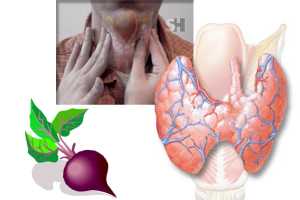 Imagen ilustrativa del artículo Remolachas, medicina para la Glándula Tiroides